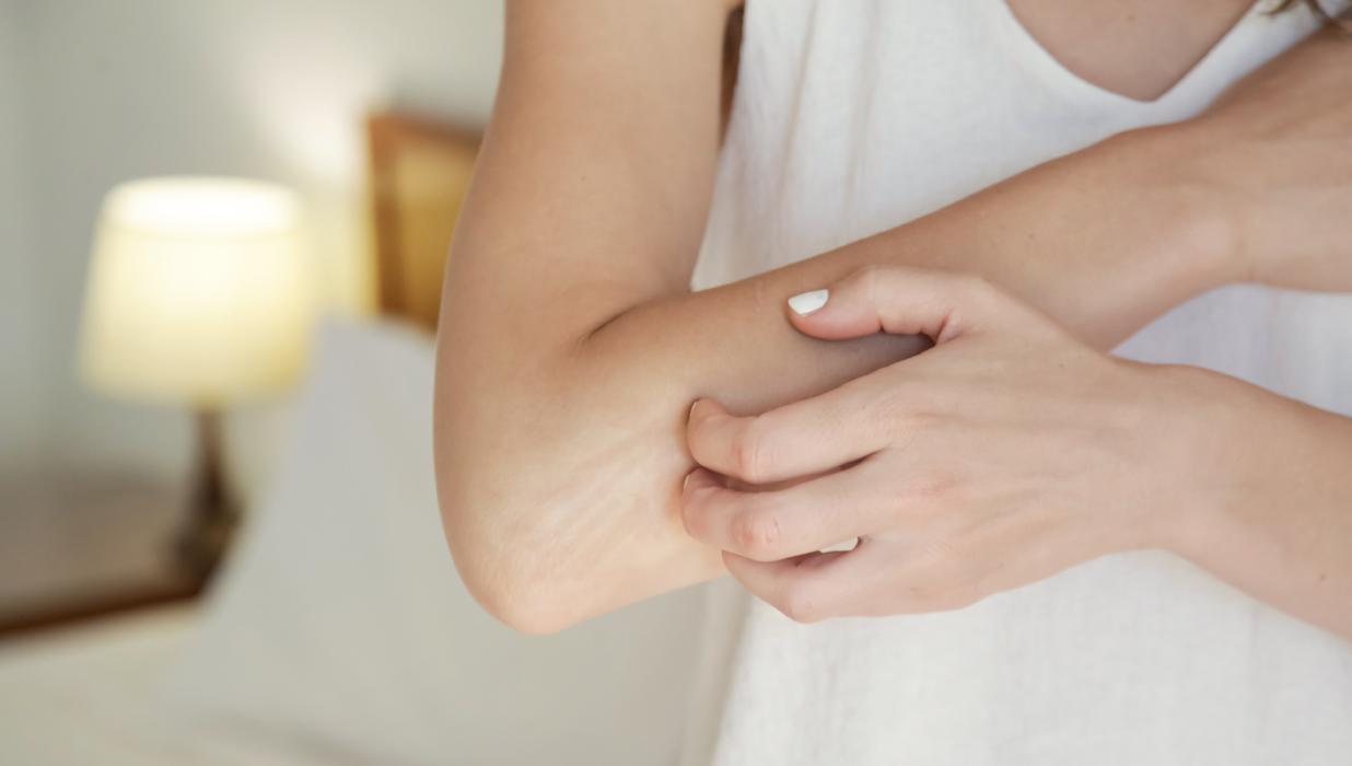 Ask An Expert– Dry Skin
